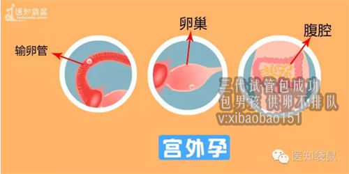 南京专业助孕包成功,苏州有做试管婴儿的医院吗